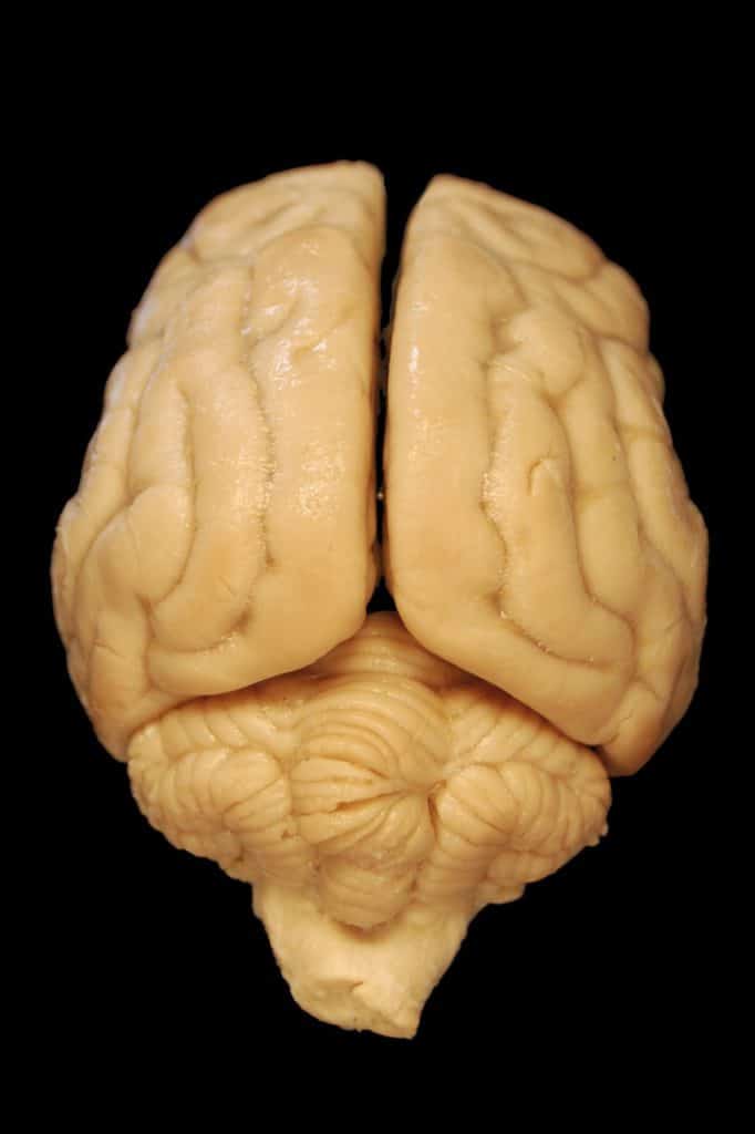 noix forme de cerveau